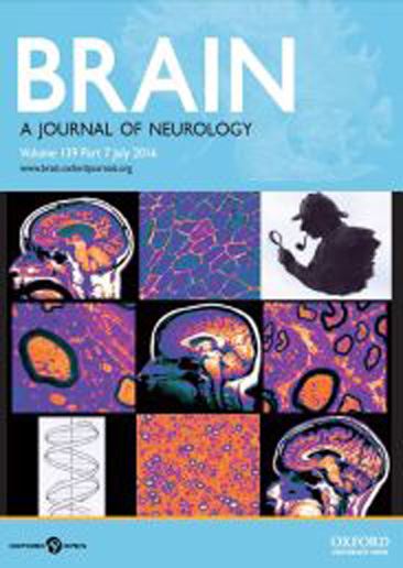 IL-10 dependent Tr1 cells attenuate astrocyte activation and ameliorate chronic CNS inflammation.